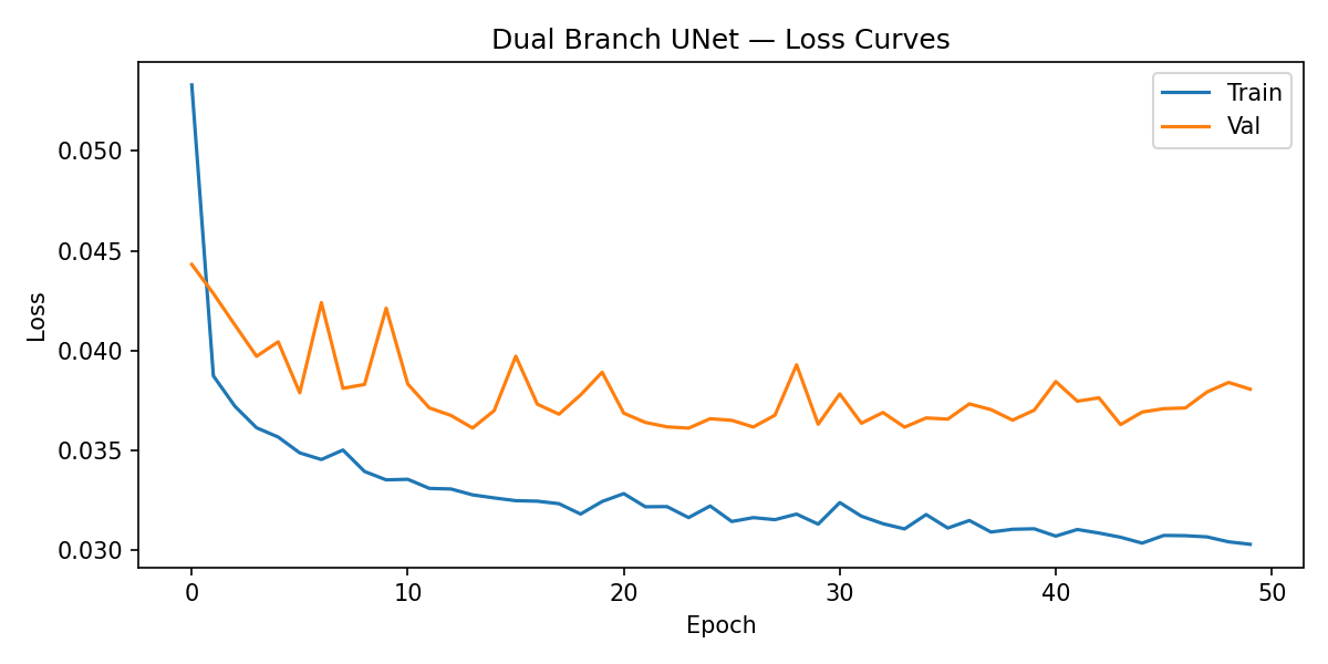 Loss curve showing train and validation loss over 50 epochs